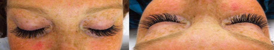 Eyelash Extensions Example 02